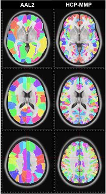 Group-Level Ranking-Based Hubness Analysis of Human Brain Connectome Reveals Significant Interhemispheric Asymmetry and Intraparcel Heterogeneities